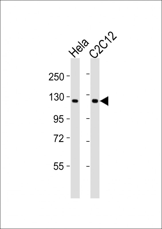 WB - PTK7 Antibody (N-Term) AP21298a